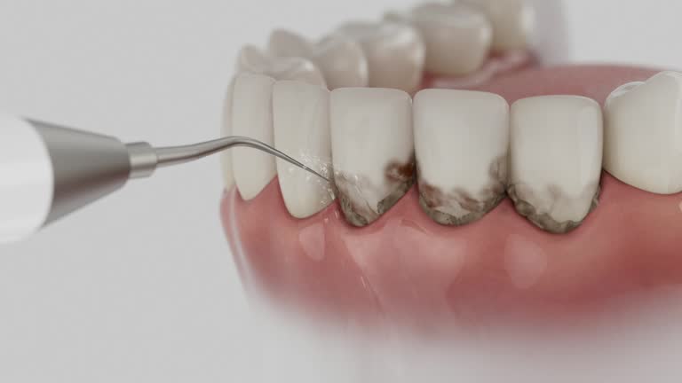 Trusted Wisdom Tooth Removal service in Ross, CA - Dentist Open Now